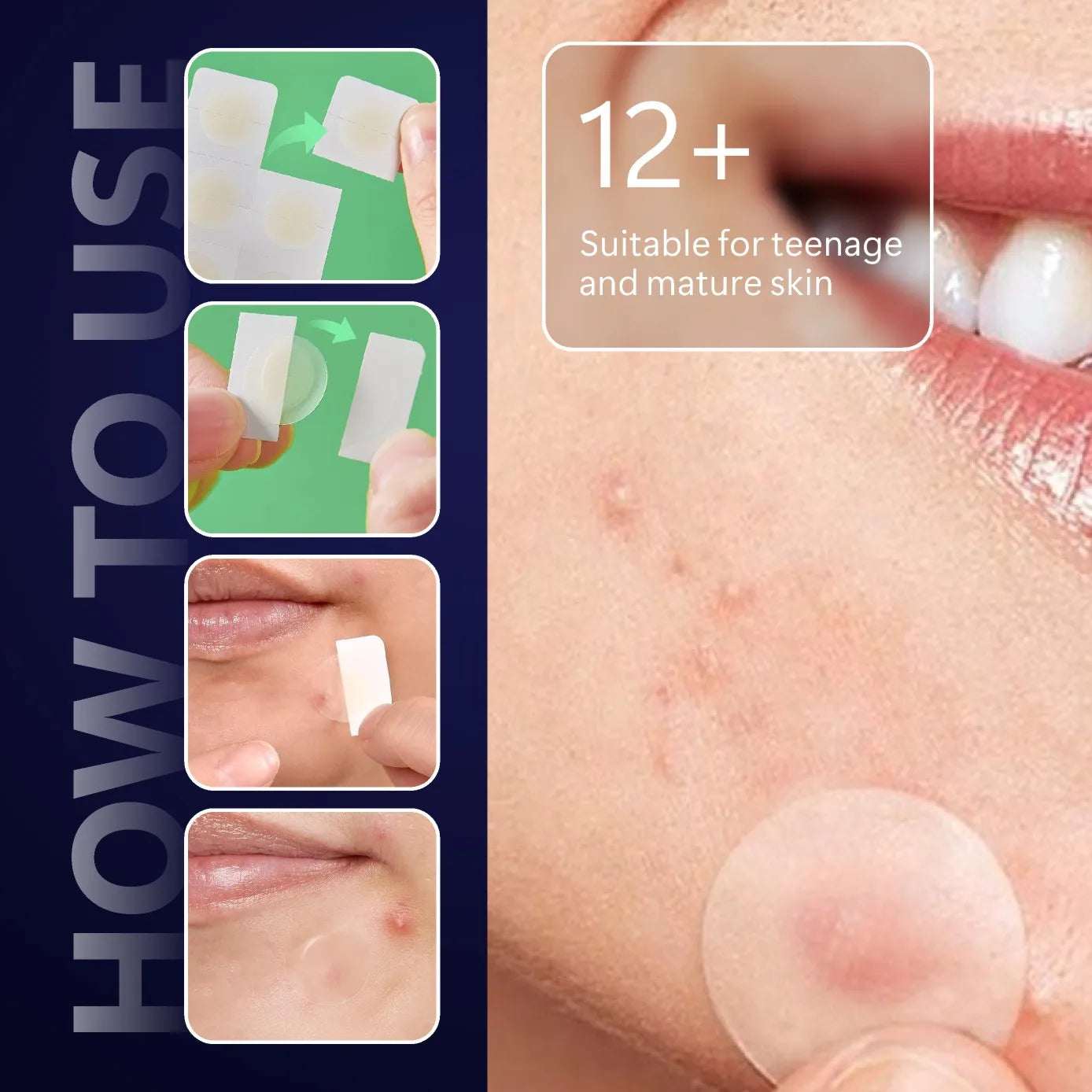 Microneedles Pimple Patch™ - Patch anti-brufoli con micro-aghi