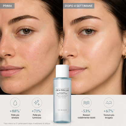 SKIN1004 Madagascar Centella Toner 210ml – Brightening and Hydrating Facial Toner with Hyaluronic Acid