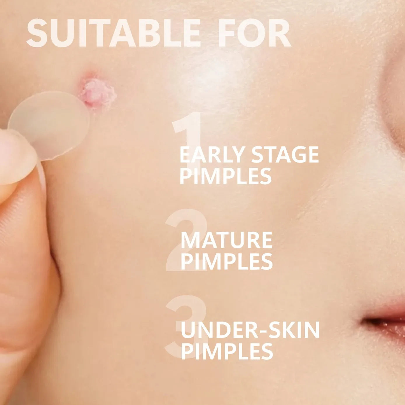 Microneedles Pimple Patch™ - Patch anti-brufoli con micro-aghi