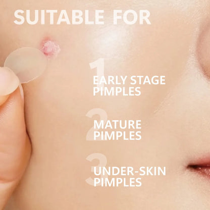 Microneedles Pimple Patch™ - Patch anti-brufoli con micro-aghi